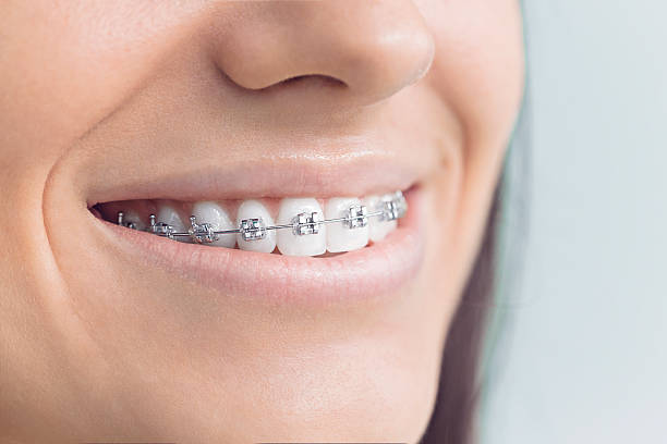 Best Traditional Braces  in Windham, OH